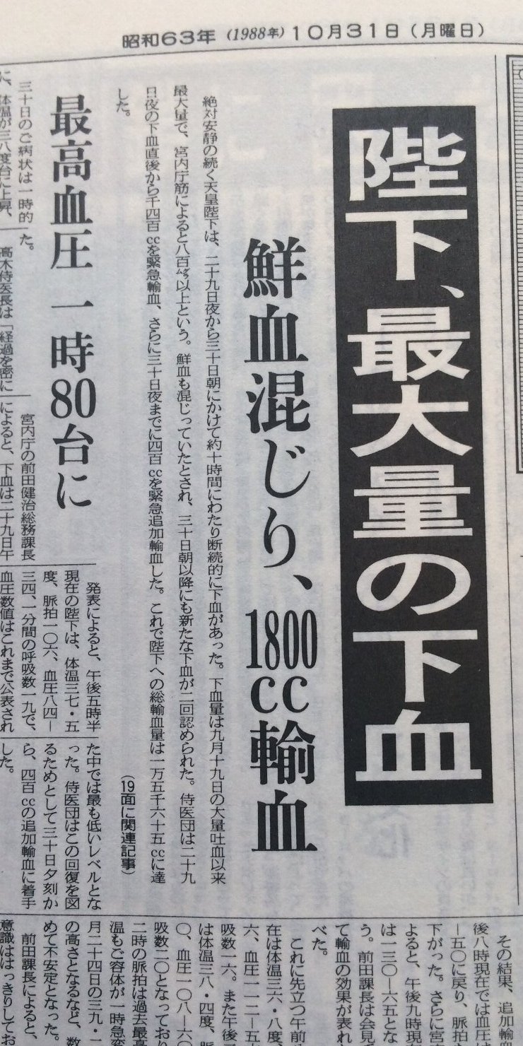 19881031福井新聞　陛下の病状