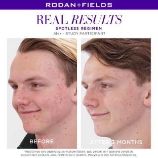 Real Results - Spotless 3 (Custom)